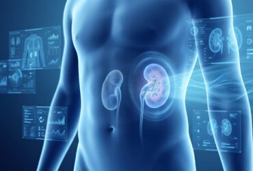 Kidney Stone